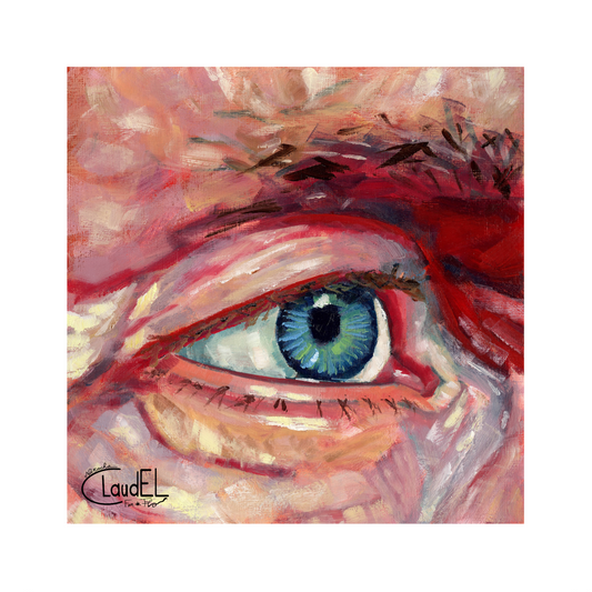 Eye 1